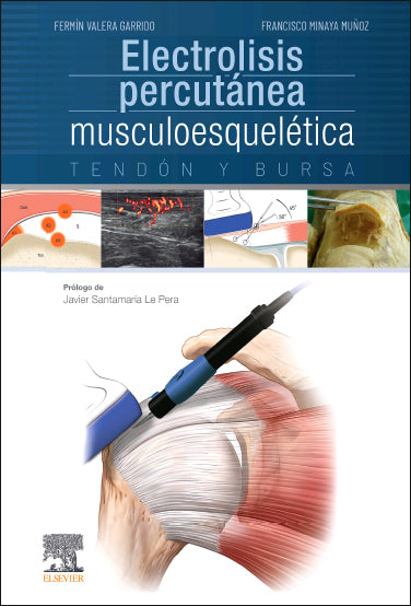 Electrolisis Percutánea Musculoesquelética. Tendón y Bursa // Fermin Valera Garrido.
