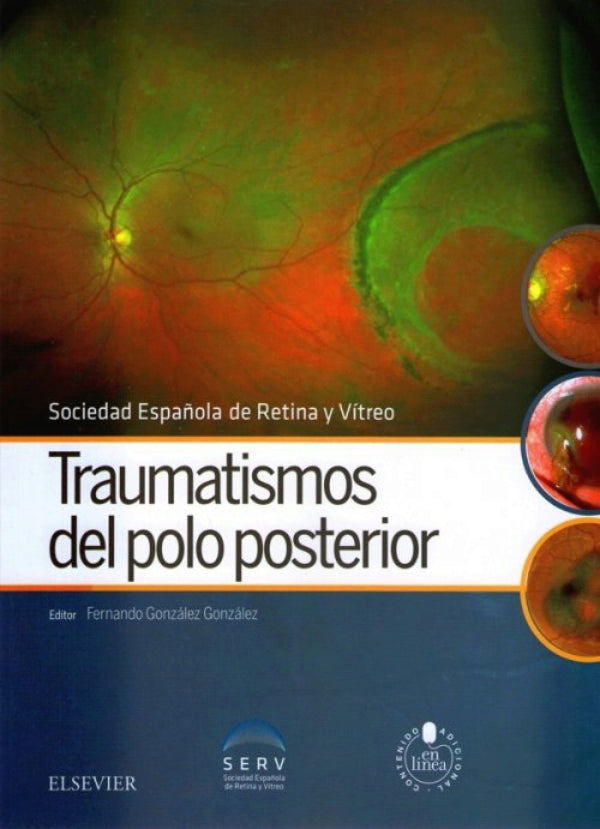 TRAUMATISMO DEL POLO POSTERIOR // Fernando González González