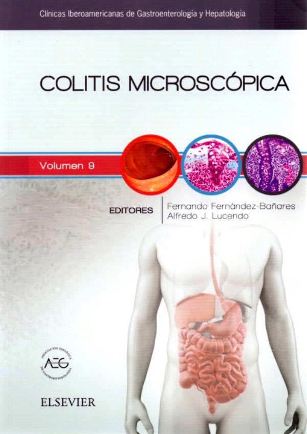 CIGH. Colitis Microscópica // Fernández Bañares. Fernando