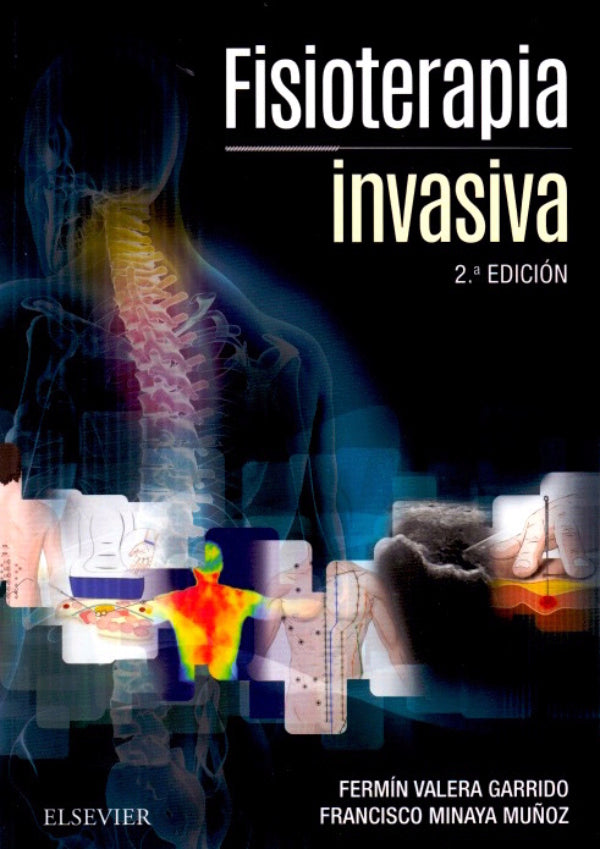 FISIOTERAPIA INVASIVA // Fermín Valera Garrido.