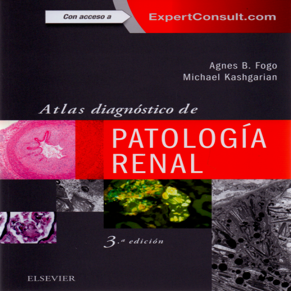 ATLAS DIAGNOSTICO DE PATOLOGIA RENAL // Fogo B. Agnes