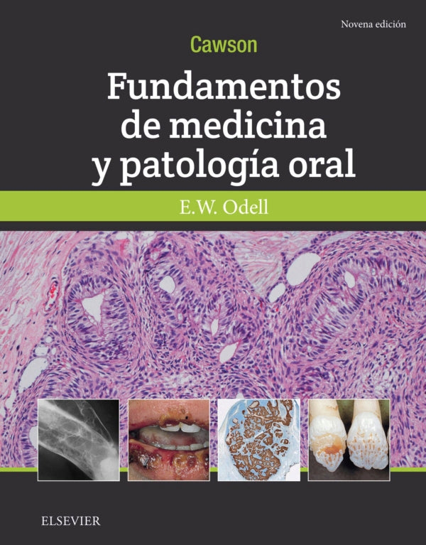 Cawson.Fundamentos de Medicina y Patología Oral // Cawson A. Roderick