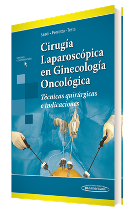CIRUGÍA LAPAROSCÓPICA EN GINECOLOGÍA ONCOLÓGICA - José Martín Saadi