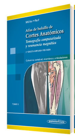 ATLAS DE BOLSILLO DE CORTES ANATÓMICOS. TOMO III - Torsten B. Möller,Emil Reif